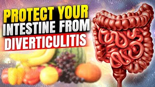 8 essential foods during flare ups with Diverticulitis [upl. by Clippard934]