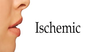 How To Say Ischemic [upl. by Ztirf763]