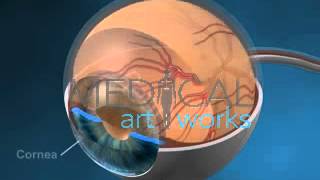 3D Medical Animation  Right eye anatomy showing retinal vessels optic nerve and normal anatomy [upl. by Nallak]