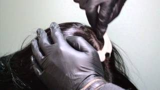 Mesotherapy  For Hair Regrowth and Hair Rejuvenation [upl. by Fevre]