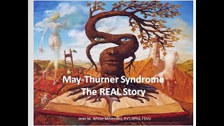 May Thurner  The REAL Story [upl. by Regine863]