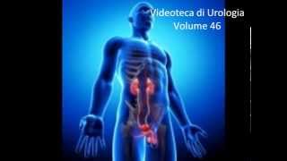 Cisti dellepididimo Video di Urologia e Andrologia  wwwurologiaandrologianet [upl. by Siol751]