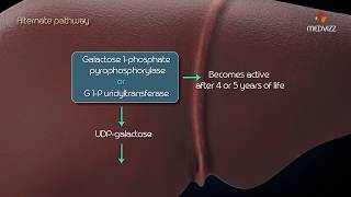 Metabolism of galactose Classic Galactosemia Galactokinase deficiency [upl. by Alejna]