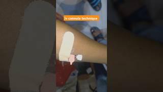 IV Cannula technique 💉💉 Cannulation Right Technique viral ivcannula ivcannulation trending [upl. by Sessler185]