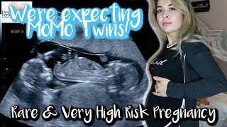 Were expecting IDENTICAL MoMo TWINS RARE PREGNANCY  EXTREMELY HIGH RISK [upl. by Irret]