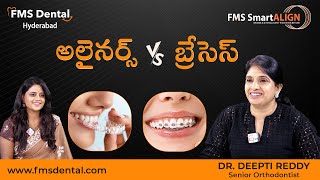 FMS Dental Orthodontist Dr Deepti Reddy About Aligners vs Braces Treatment  sumantvtelugulive [upl. by Monique]