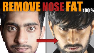 Mote Naak Ko Patla Karne Ka Tarika हिंदी How To REMOVE Nose Fat  100 Slim  Sharp Big Nose [upl. by Besse204]