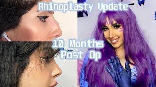 RHINOPLASTY QampA  10 months post OP  Turkey Rhinoplasty [upl. by Aisek275]