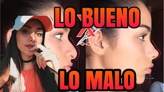 Lo BUENO y lo MALO Respingadores nasales  Rinoplastia Casera en minutos [upl. by Nedle980]