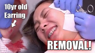 REMOVING An Earring That Was STUCK for 10 YEARS [upl. by Sivad]