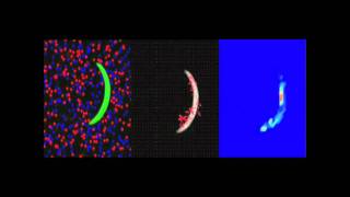 Plasmodium Sporozoite Motility Is Modulated by the Turnover of Discrete Adhesion Sites [upl. by Aicat]