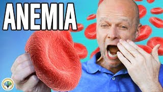 Anemia Explained Simply [upl. by Islean]