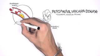 Cardiovascular Disease Overview [upl. by Nylecsoj960]