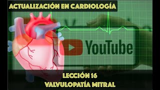 16 VALVULOPATÍA MITRAL [upl. by Edahsalof]