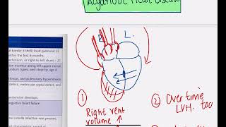 Pediatric cardiac defects  Acyanotic amp Cyanotic [upl. by Rohn748]