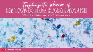 Trophozoite phase of Entamoeba hartmanni under the microscope with Trichrome stain [upl. by Fennessy]