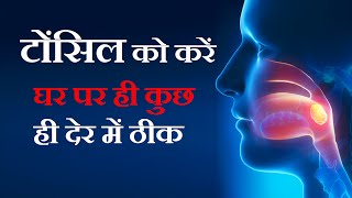 टॉन्सिल्स के घरेलू उपचार Gharelu Upchar for Tonsils in Hindi  Tonsil Home Remedies [upl. by Eyatnod610]