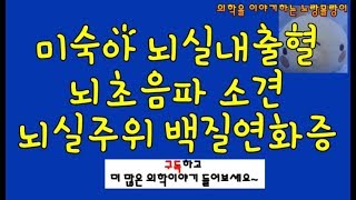 미숙아 뇌실내출혈 두개내 출혈과 뇌실주위 백질연화증periventricular leukomalacia [upl. by Haeckel428]