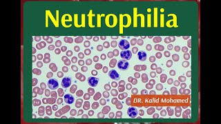 Neutrophilia and Neutropenia Causes amp Evaluation [upl. by Nettle]