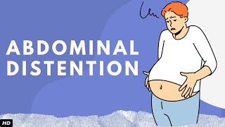 Abdominal Distention Everything You Need To Know [upl. by Drye340]