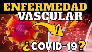 CUIDADO ⚠️ CIENTÍFICOS REVELARÍAN QUE COVID19 SERÍA UNA ENFERMEDAD VASCULAR [upl. by Stoat124]