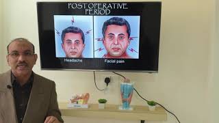 Deviated nasal septum Hindi Patient teaching programme [upl. by Atinel]