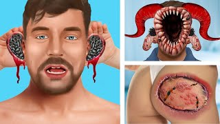 Asmr animation infected head [upl. by Atoiyanap698]