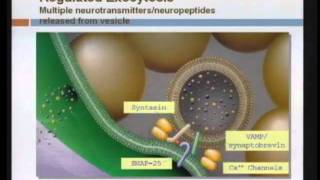 Spasticity Management [upl. by Loy]