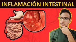 5 COSAS QUE TE INFLAMAN EL INTESTINO Síndrome de Intestino Irritable [upl. by Keviv]