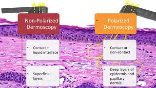 Principles of Dermoscopy  Dr Natalia Jaimes [upl. by Itram501]