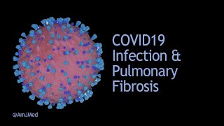 COVID19 Infection amp Pulmonary Fibrosis [upl. by Varrian]