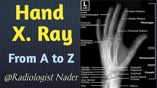 اوضاعالاشعةالعادية علي اليدوالاصابع  XRay hand and fingers positions [upl. by Mallory736]