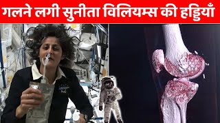 गलने लगी सुनीता विलियम्स की हड्डियाँ  Astronaut Sunita Williamss Bones are Getting Weak [upl. by Eaton]