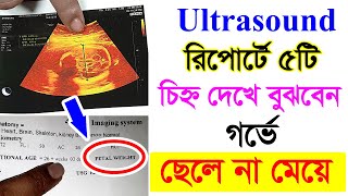 আল্ট্রাসাউন্ড রিপোর্টে যে ৫ টি চিহ্ন দেখে যেভাবে নিজে বুঝবেন ছেলে না মেয়ে হবে  Ultrasound report1 [upl. by Dahle218]