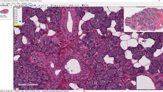 Unit 3 histo  Parotid Gland [upl. by Tezile]