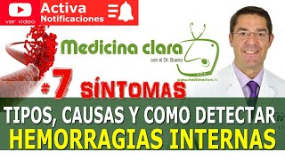 HEMORRAGIA o SANGRADO INTERNO por GOLPES 7 SÍNTOMAS DE ALARMA  Medicina Clara [upl. by Ydde]