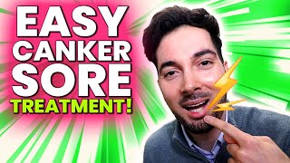 How To Get Rid Of Canker Sores Treatment [upl. by Lleryt3]