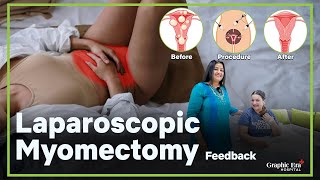 Laparoscopic Myomectomy  Fibroids Removal  Obstetrics amp Gynaecology  Graphic Era  GEIMS [upl. by Anoek]