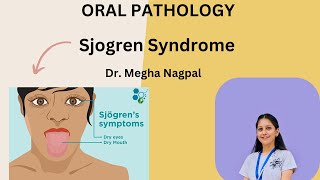 Sjogren Syndrome  Sicca Syndrome  Oral Pathology  Easiest Explanation [upl. by Kaila640]