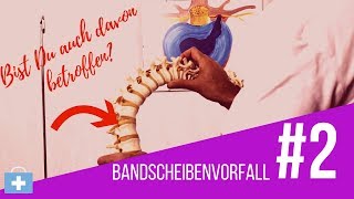 Bandscheibenvorfall😲Das passiert in Deinem Köper⚠️ [upl. by Ellebanna]