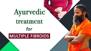 Ayurvedic Treatment for Multiple Fibroids  Swami Ramdev [upl. by Aleina559]