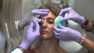 What is Botox and How Does it Work [upl. by Hnacogn]