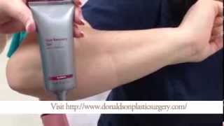 How To Apply Scar Gel or Cream [upl. by Amliw]