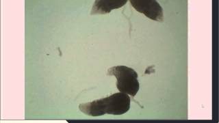 Drosophila Ovarian Dissection for Immunohistochemistry [upl. by Naibaf]