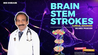 BRAIN STEM STROKES  Diagnosis and Localization  NEUROLOGY [upl. by Yznil404]