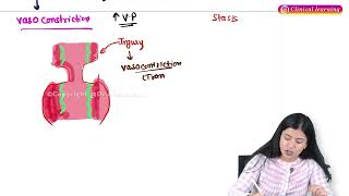 Acute Inflammation Part1 Pathology Hindi Lectures [upl. by Sherlock]