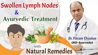 Swollen Lymph Nodes and Ayurvedic Treatment with Natural Remedies [upl. by Nueovas628]