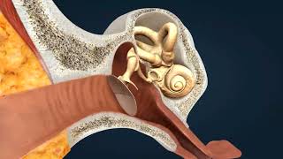 Eustachian Tube Dysfunction  quotWhats That Strange Crackling Soundquot Explained [upl. by Otipaga]