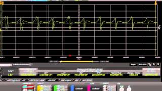 한국어 Keysight N6705B N6781A 14585A를 이용한 DC 모터 전류 소모 측정 [upl. by Ez]