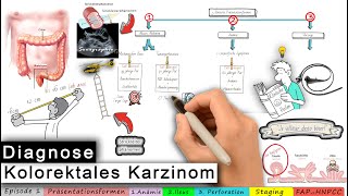 kolorektales Karzinom Ep 13 Diagnose [upl. by Ithnan124]